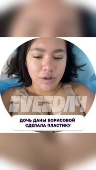Ничего себе 🤯 Дочь Даны Борисовой сделала пластику