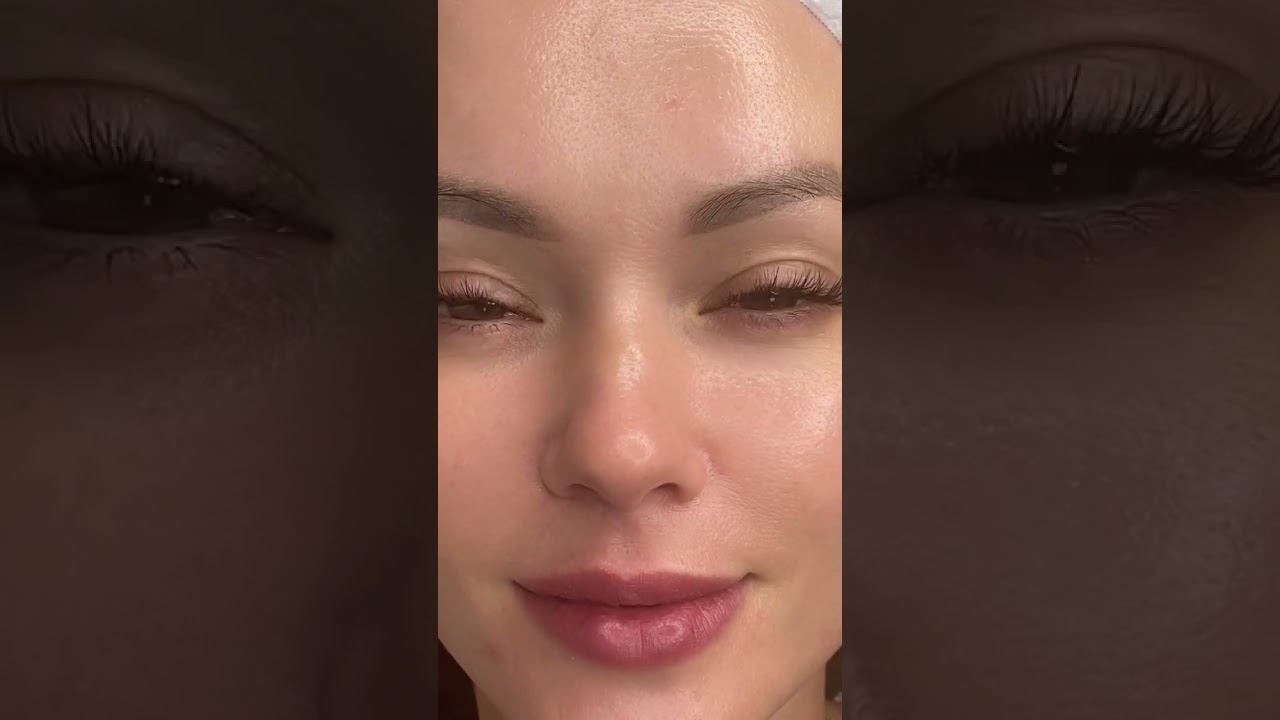 #татьяналексус #beauty #лифтингмосква #пилинг #пилинглица #пилинги #красотаназдоровье #botoxtraining