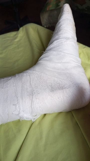 я сломам себе палец