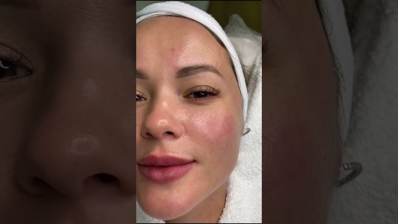 Уход за кожей в зимний период. Косметолог Калининград. Татьяна Лексус