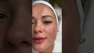 Уход за кожей в зимний период. Косметолог Калининград. Татьяна Лексус