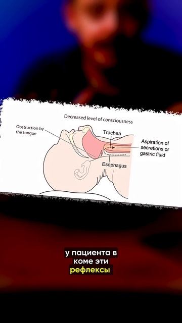Как быстро выйти из комы?