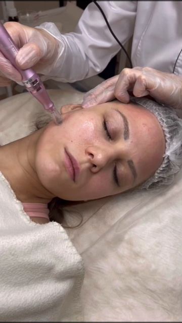 👍 Когда можно рекомендовать микронидлинг