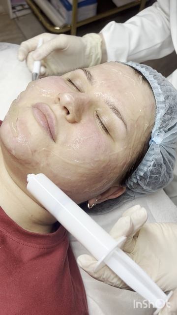 Мастер Вероники Булкина - Чистка, пилинги, Мезотерапия, Биоревитализация