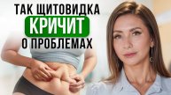 Первые СИМПТОМЫ проблем с ЩИТОВИДНОЙ ЖЕЛЕЗОЙ. Как не пропустить ГИПОТИРЕОЗ?
