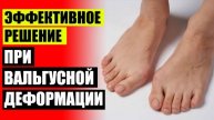 Hallux valgus цена