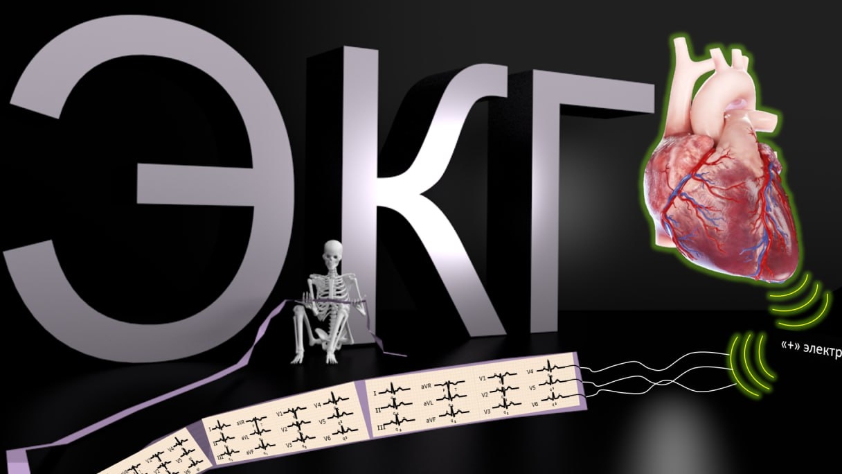 ЭКГ по-быстрому | Medanatfarm
