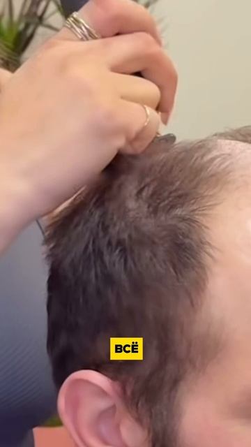 Густые волосы это реально! В любое время