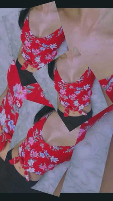 Увеличение груди.