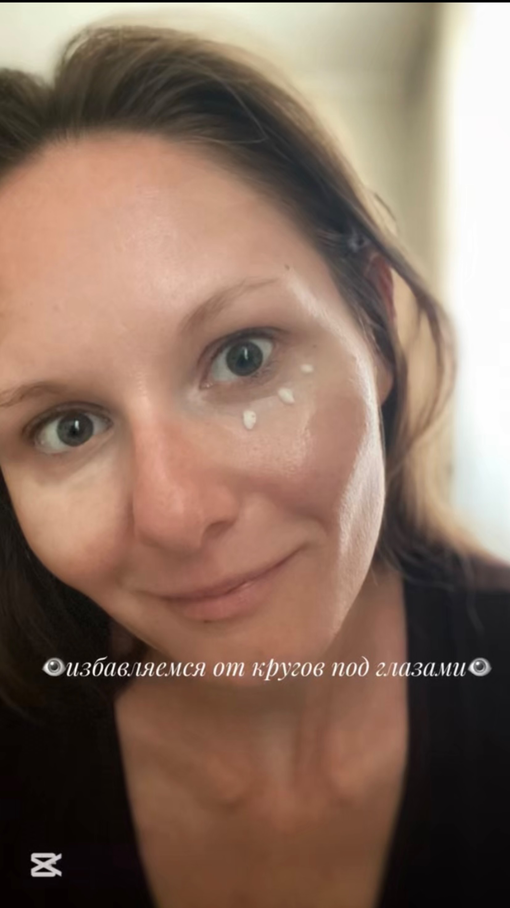 👁️Избавляемся от кругов под глазами👁️Арт Ozon 1629740243👁️