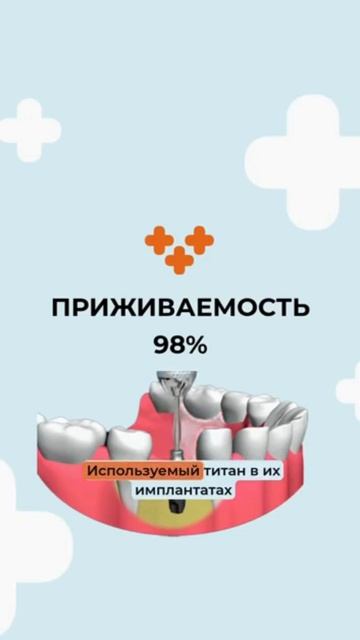 Имплантация зубов — серьёзное решение, и материал играет ключевую роль в долговечности результата.