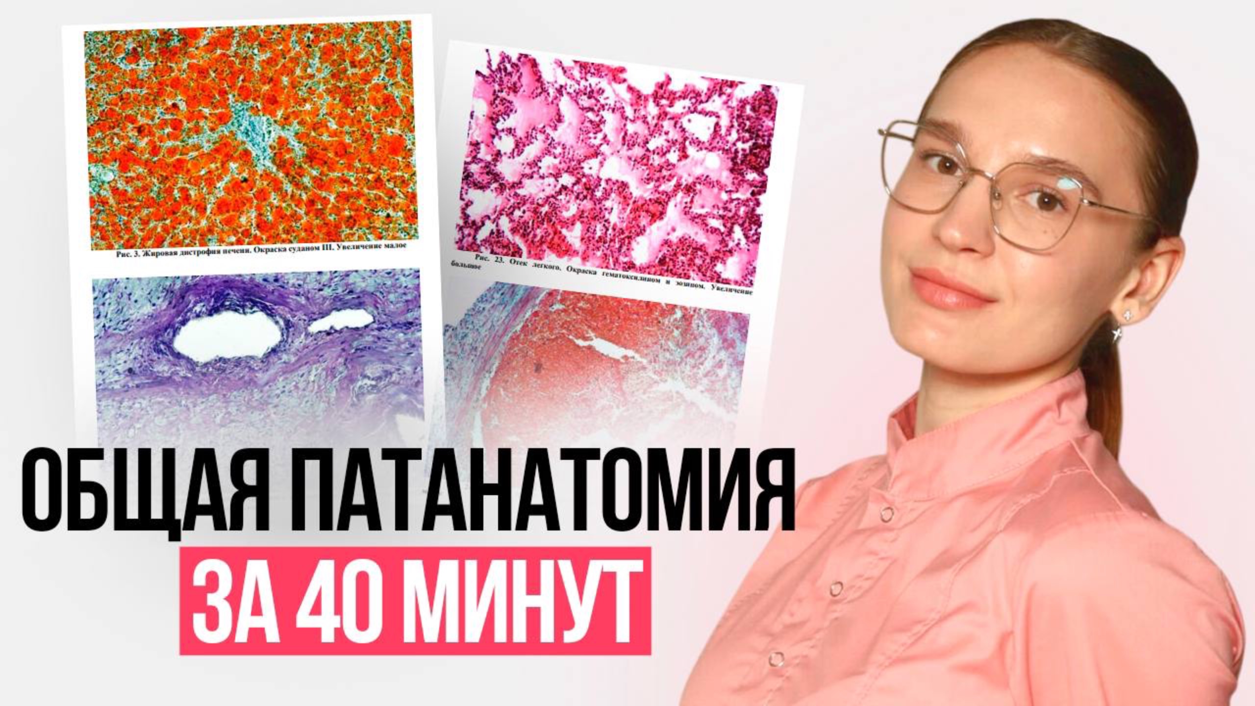 Вся общая патанатомия за 20 минут