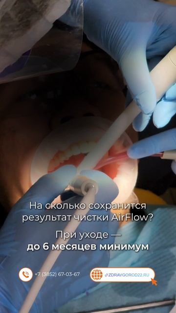 На сколько сохранится результат чистки AirFlow?