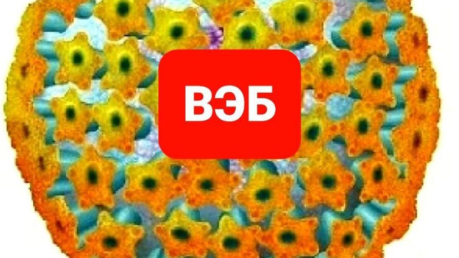 ВЭБ