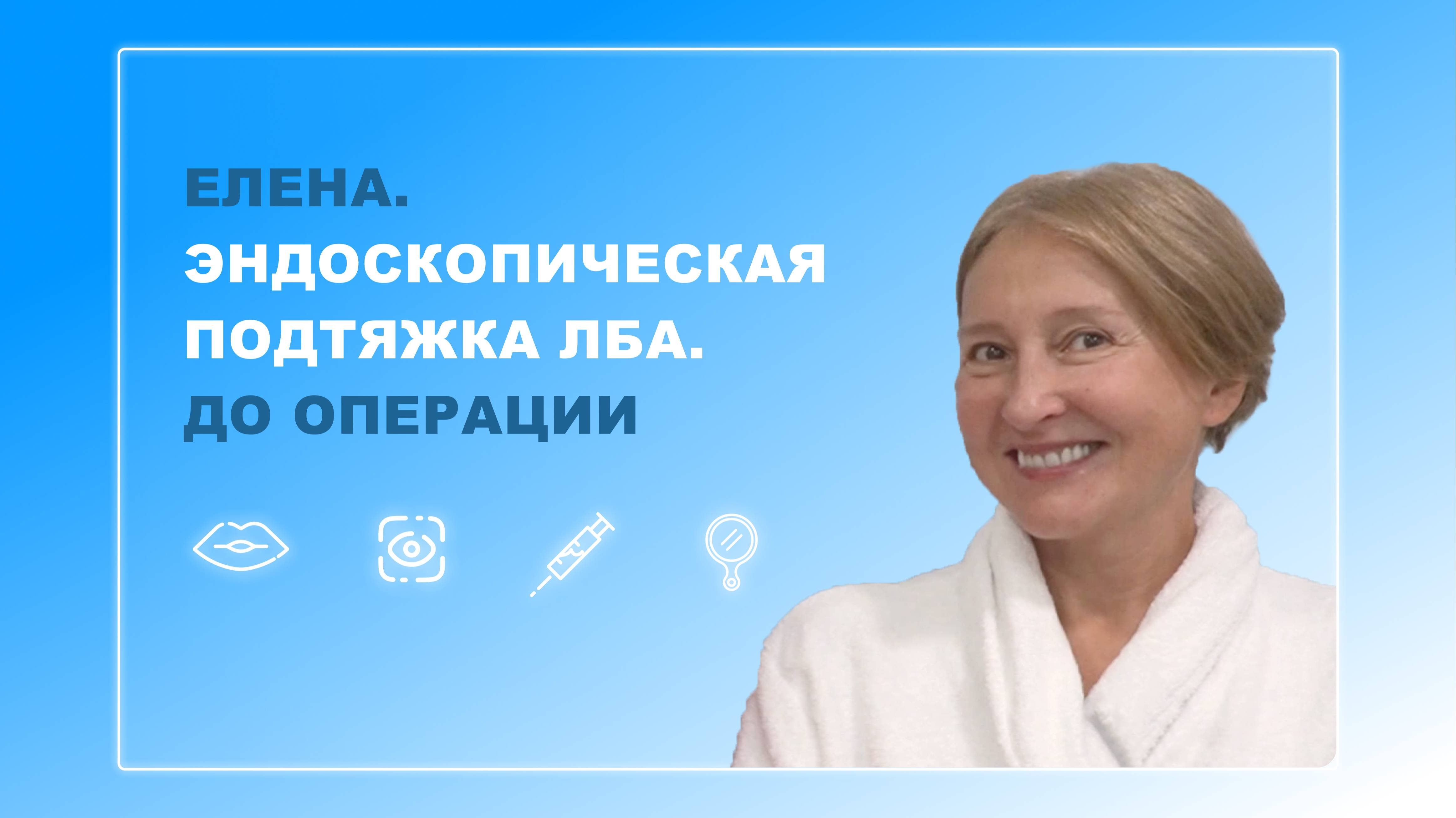 Елена. Эндоскопическая подтяжка лба. До операции