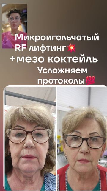 микроиголочка