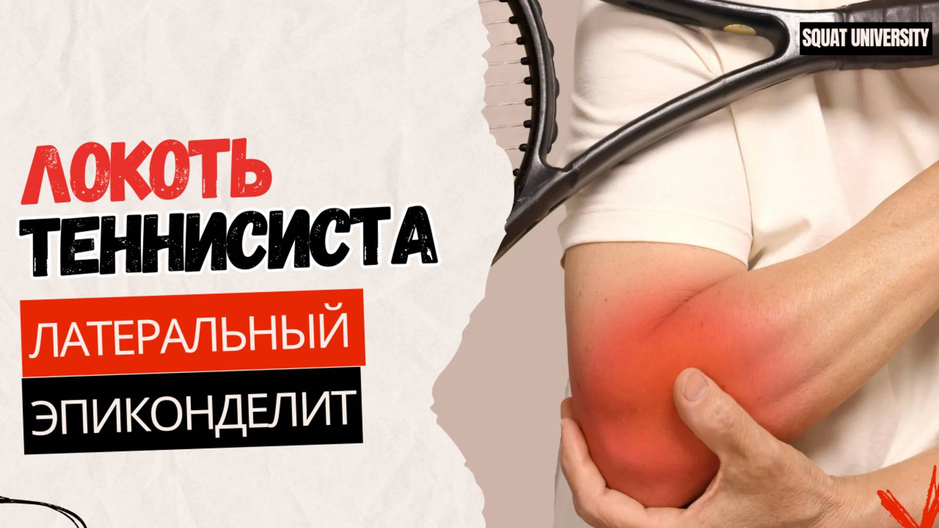 Как навсегда вылечить локоть теннисиста без хирургического вмешательства!