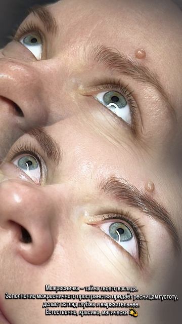 Межресничное пространство