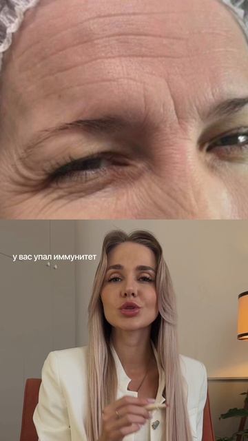 Почему ботокс не встает или держится буквально пару месяцев