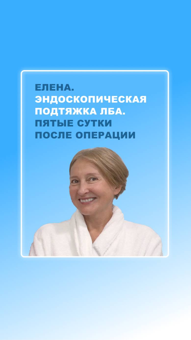 Елена. Эндоскопическая подтяжка лба. Пятые сутки после операции