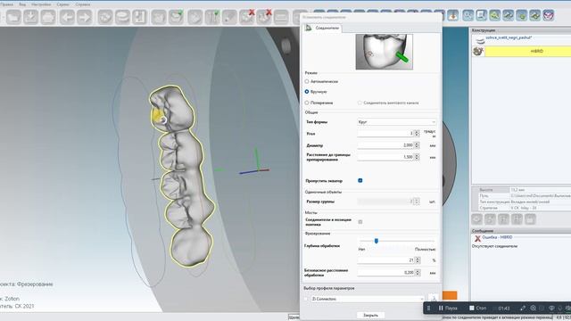 HyperDent - Hybrid Bar
