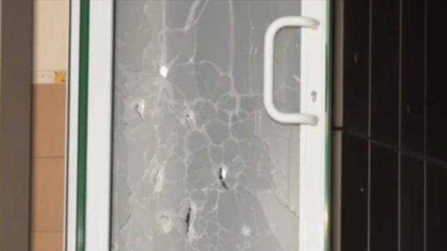 Дончанину извлекли из головы чип от БПЛА, атаковавшего Донецк 😳