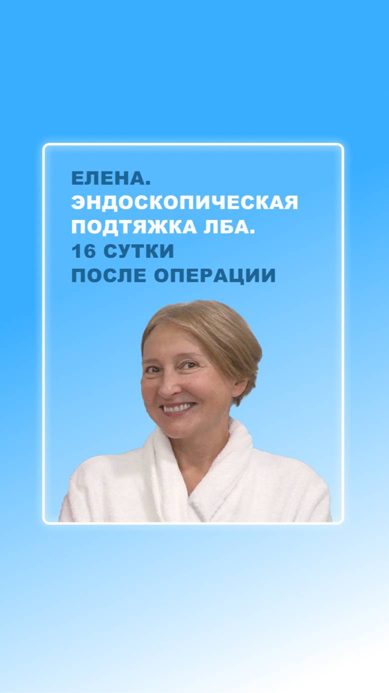 Елена. Подтяжка лба. 16 сутки после операции