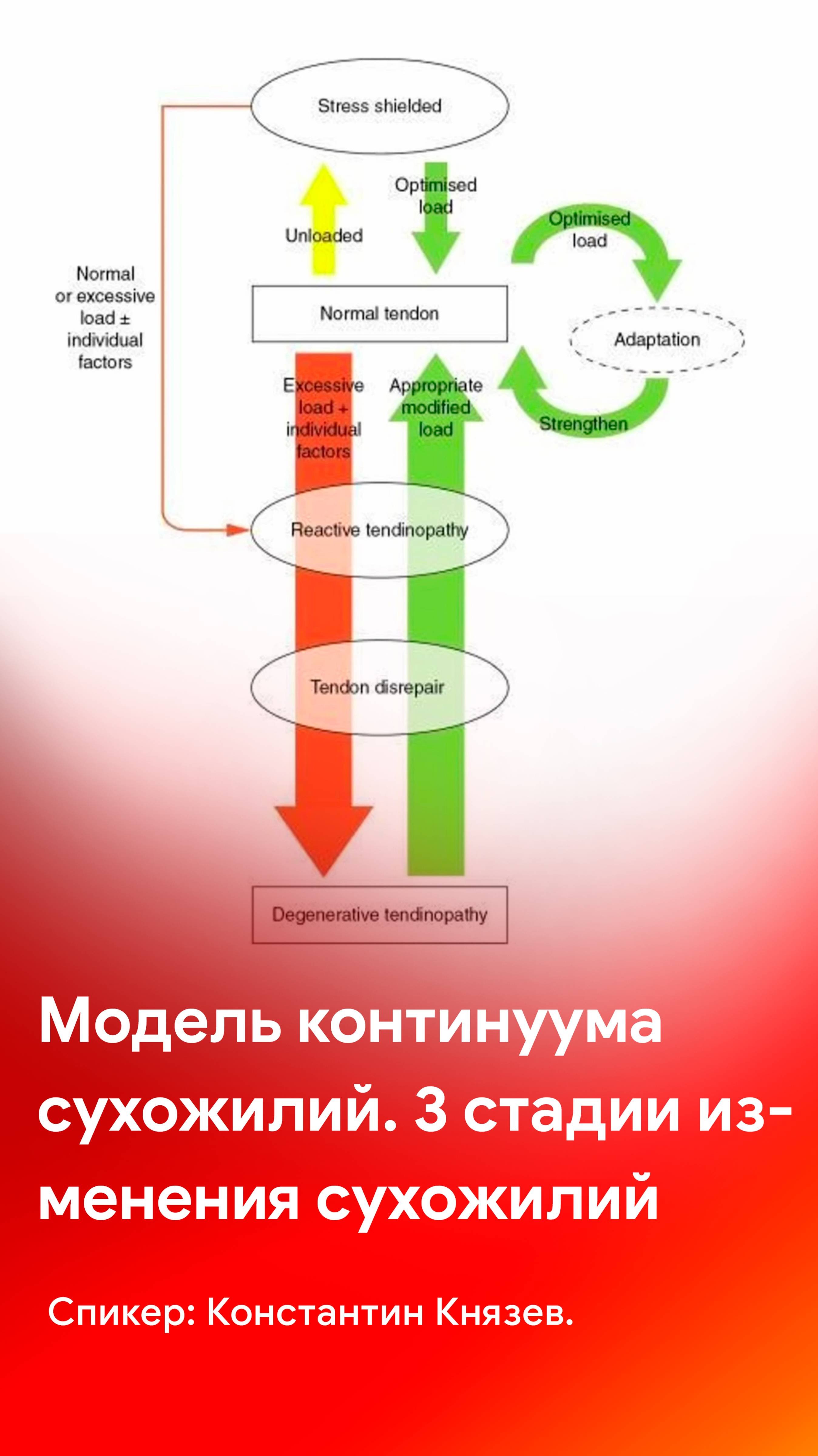 УЗИ сухожилий: модель континуума и три стадии изменения сухожилий