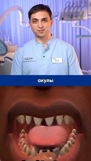 Они делают акульи зубы