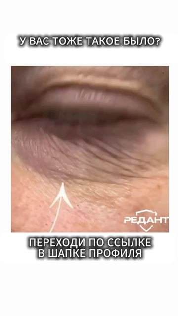 Переходите в шапку профиля — там полезные материалы для здоровья нервов и энергии ⚡
