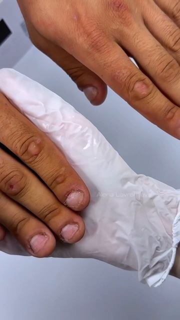 ГРЫЗЕТ и ковыряет ногтирезультат после 3 маникюров смотри в полном видео на Rutube