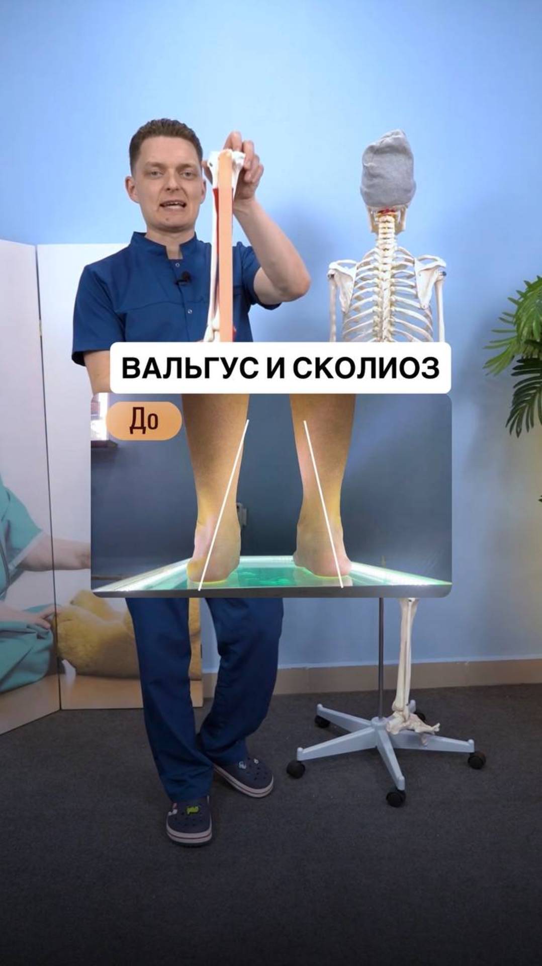 Может ли завал стопы вызвать сколиоз?