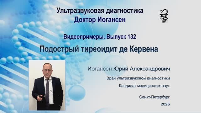 УЗИ. Доктор Иогансен. Видеопримеры. Выпуск 132. Подострый тиреоидит де Кервена.