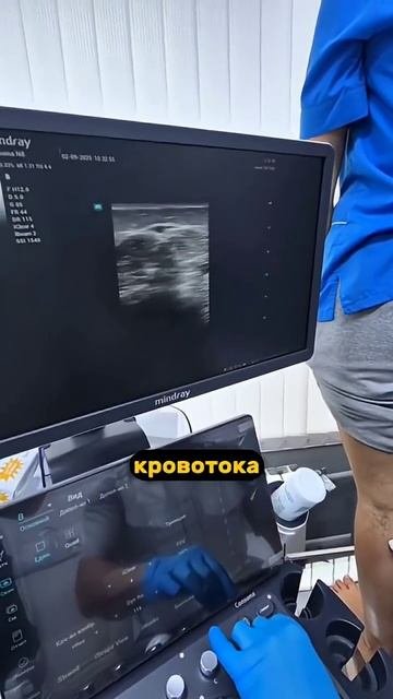 Узи вен что видит флеболог.