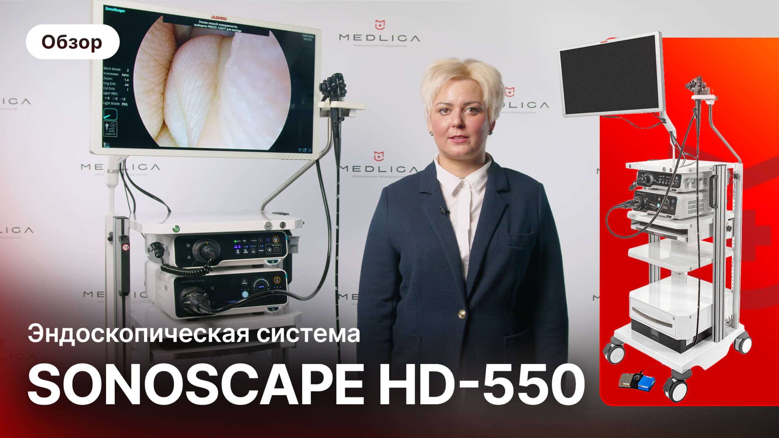 SonoScape HD-550: полный обзор эндоскопической системы нового поколения