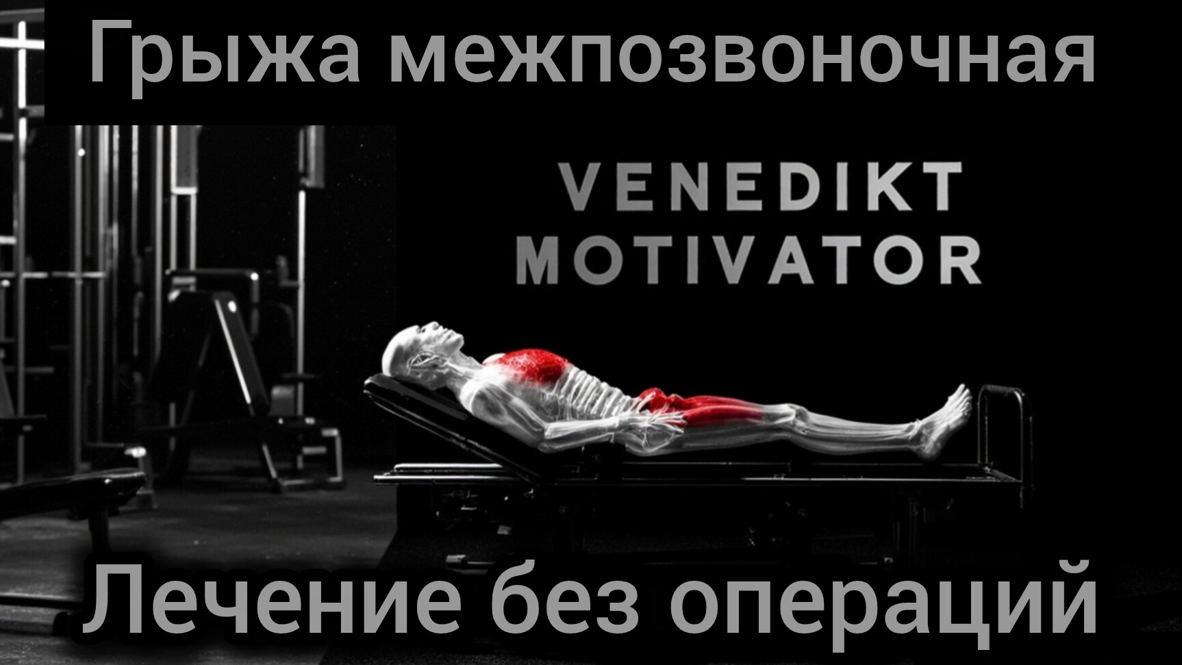грыжа межпозвоночная