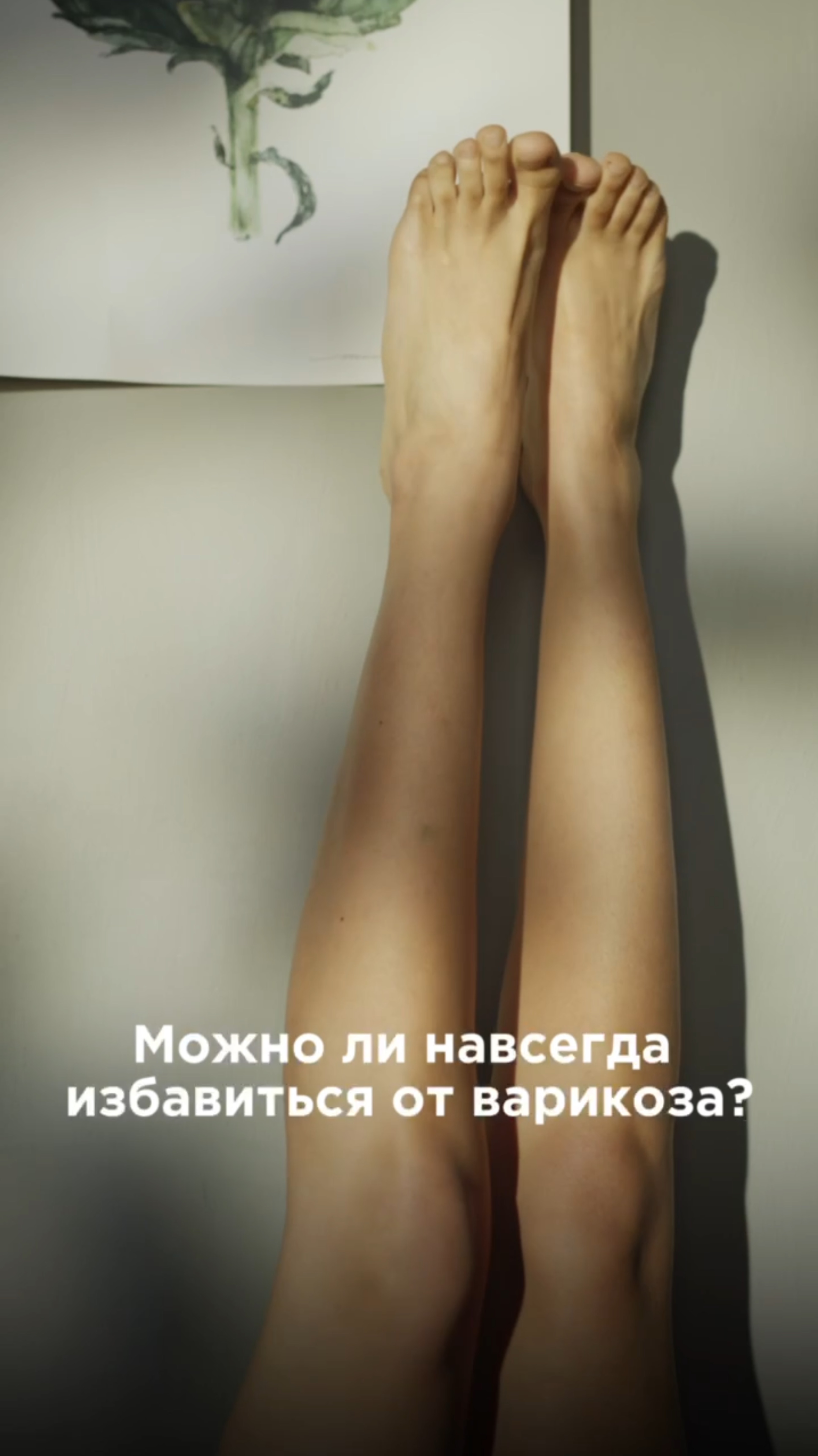 Можно ли избавиться от варикоза?