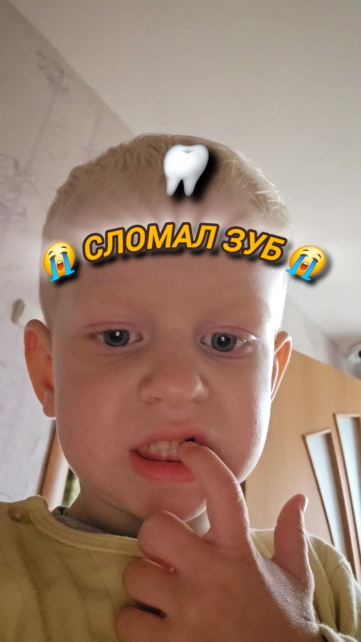 Сломал передний зуб...в стоматологиях не принимают😭