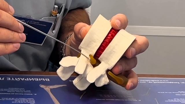 Николай Карпов, нейрохирург