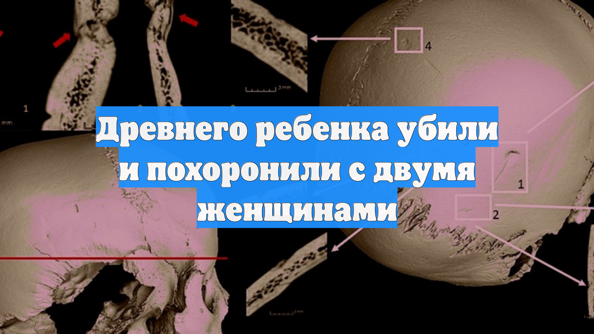 Древнего ребенка убили и похоронили с двумя женщинами