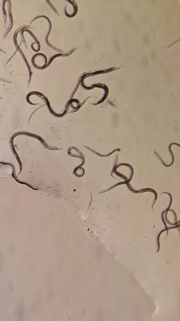 Паразиты не любят чеснок 🧄Сок чеснока помогает очищать организм, угнетает рост паразитов