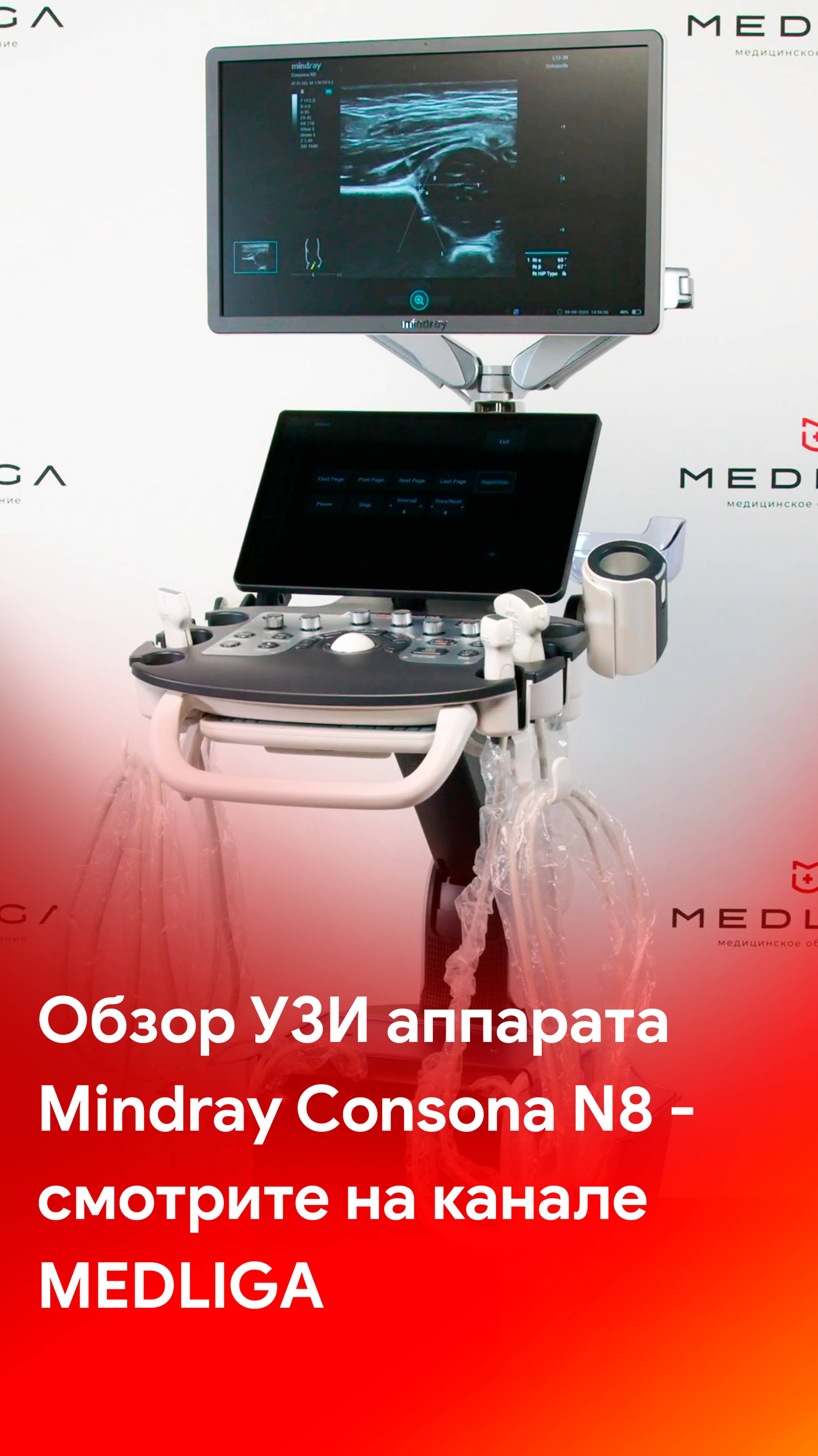 Mindray Consona N8 - обзор УЗ-аппарата уже на канале MEDLIGA