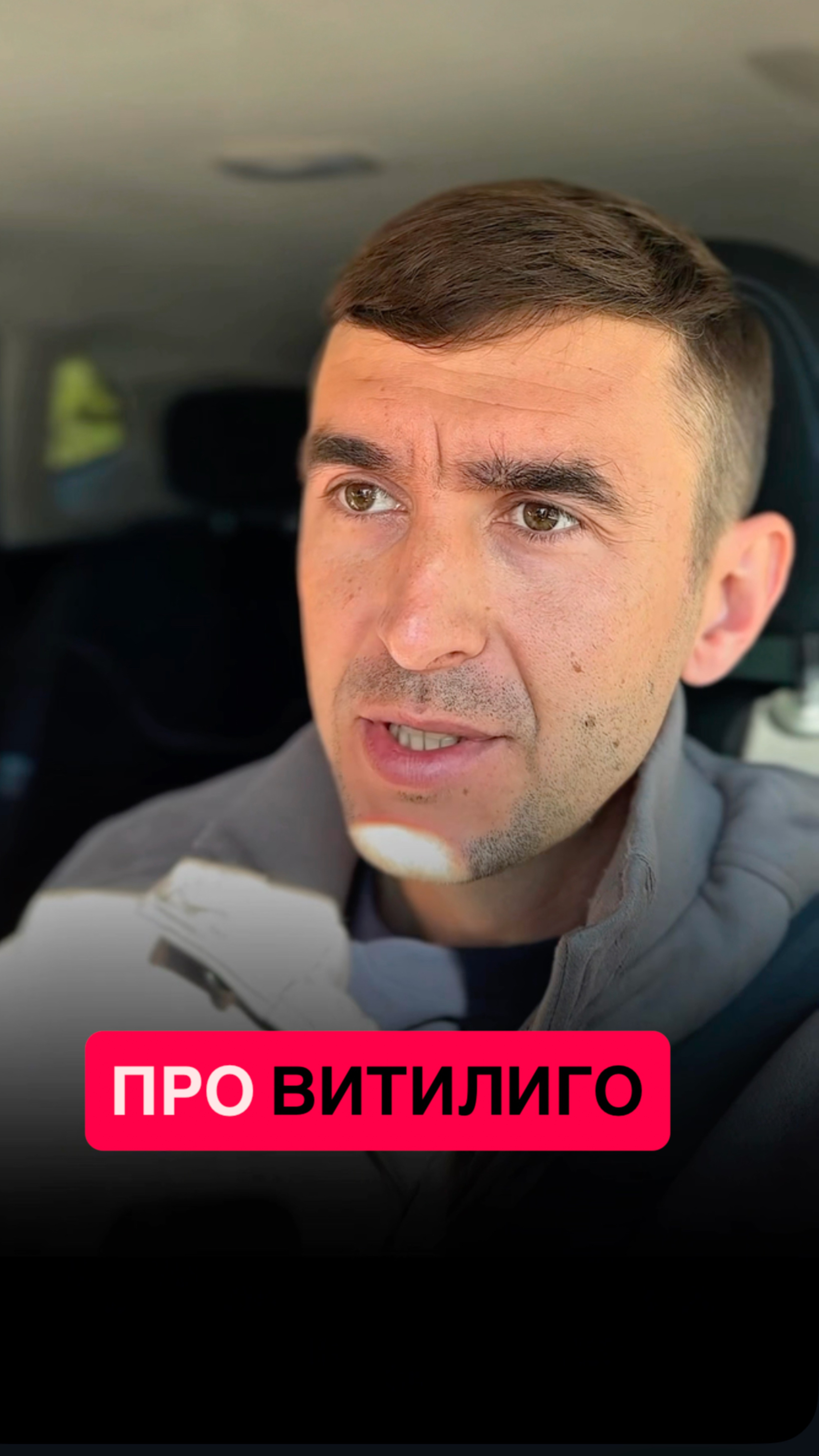 ВИТИЛИГО - проблема в ПСИХОСОМАТИКЕ или в здоровье?