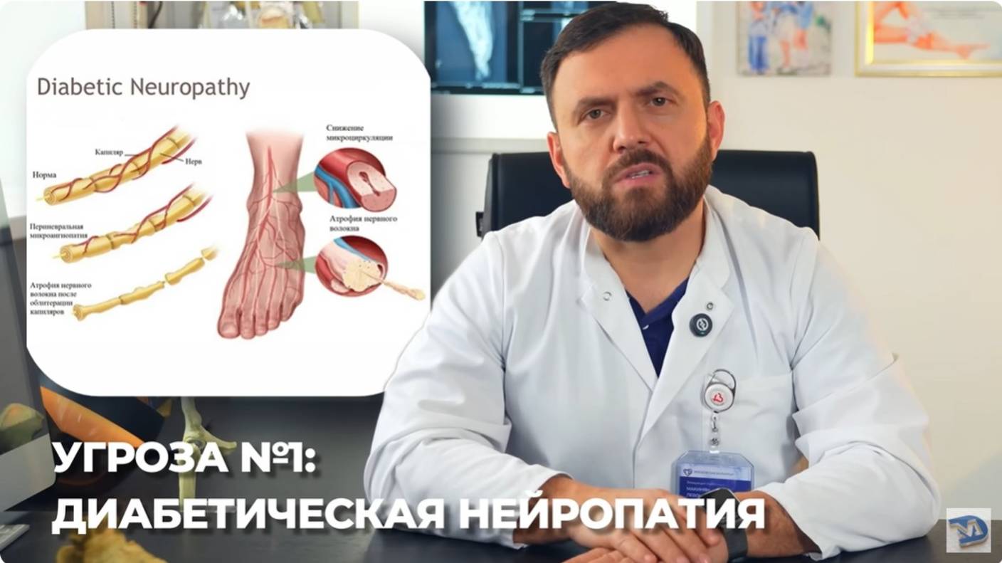 КАК ДИАБЕТ РАЗРУШАЕТ НОГИ! КАК ОСТАНОВИТЬ ЭТОТ ПРОЦЕСС.