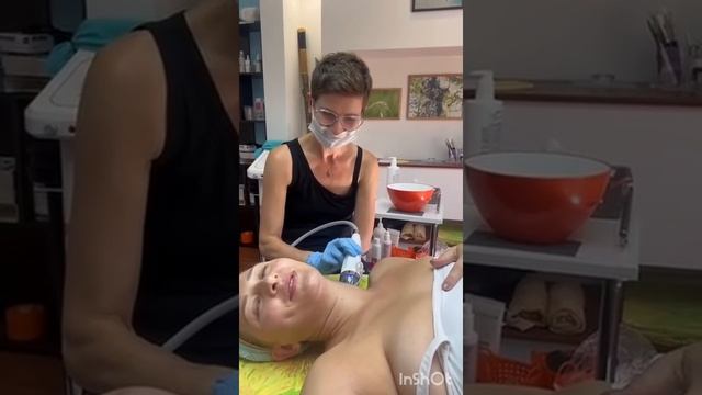 микроиголочка