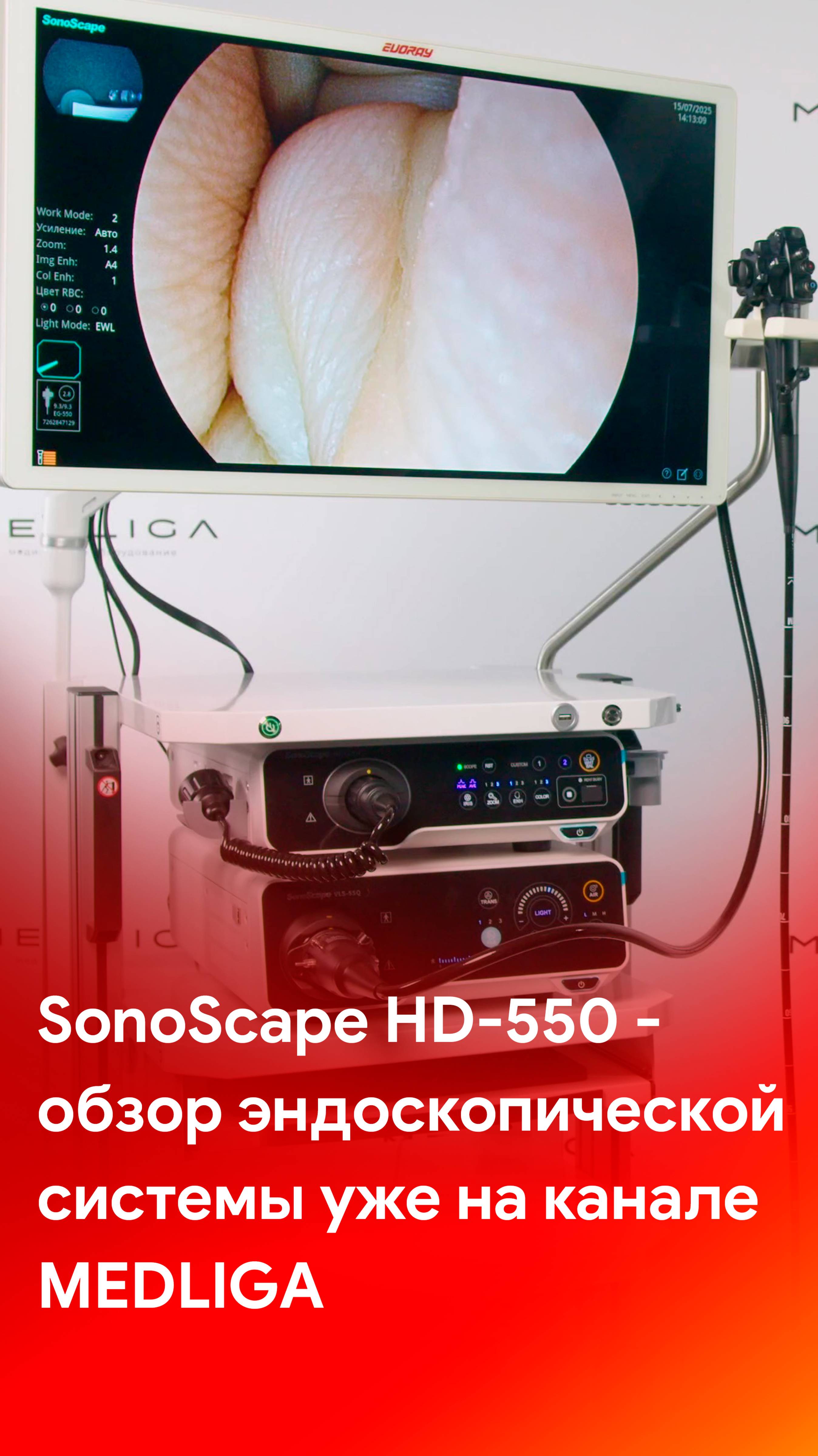 SonoScape HD-550 - обзор видеоэндоскопической системы уже на канале MEDLIGA