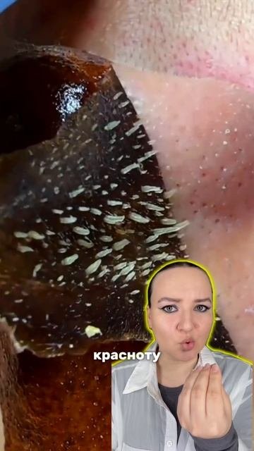 Пилинг от прыщей Cosmeya W123351 (ВБ)#макияж#пилинг