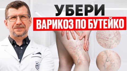 Как устранить варикоз и геморрой помогает метод Бутейко.