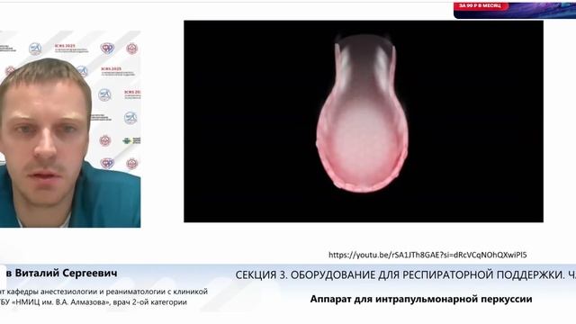 Аппарат для интрапульмонарной перкуссии Шабаев В.С.