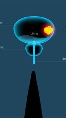 Как Лечится РАК в мире 😳😢🚫❌🫷 #uydadavolanish